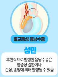 비교통성 음낭수종 일러스트