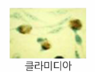 클라미디아 현미경 이미지